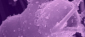 Focal adhesion complexes of osteoblasts on titanium surface